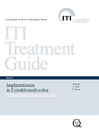 ITI Treatment Guide 302